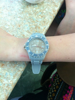 Отдается в дар «Часы ice watch»