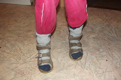 Отдается в дар «Ортопедические сандали»