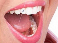 Отдается в дар лечение одного зуба